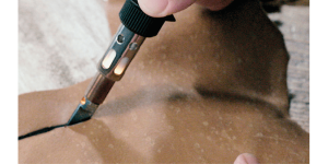 2000-7 VersaTip™ Precision Butane Torch